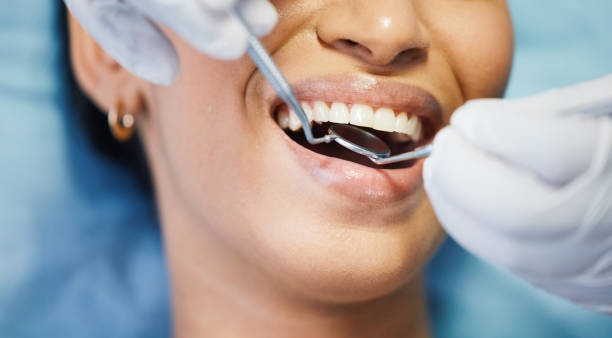 Best Knocked-Out Tooth Emergency  in Slidell, LA