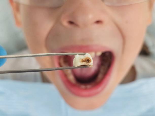Best Cracked Tooth Emergency Dentist  in Slidell, LA